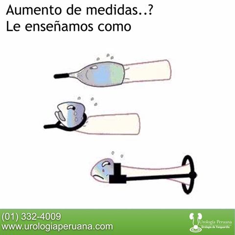 El aumento de la dimensión sexual el miembro